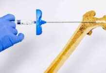 Kırılgan Kemikleri Güçlendiren Enjekte Edilebilir Hidrojel krlgan-kemikleri-glendiren-enjekte-edilebilir-hidrojel