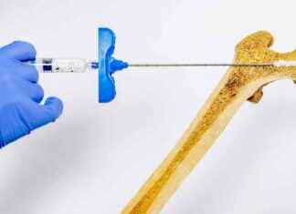 Kırılgan Kemikleri Güçlendiren Enjekte Edilebilir Hidrojel krlgan-kemikleri-glendiren-enjekte-edilebilir-hidrojel