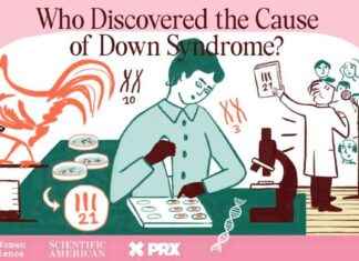 Down Sendromu’nun Nedenini Keşfeden Araştırmacı Yıllarca Kredi Alamadı down-sendromunun-nedenini-kefeden-aratrmac-yllarca-kredi-alamad