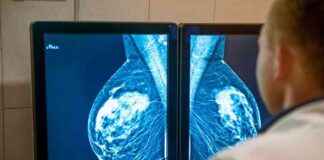 Genetik Keşifler Siyah Kadınların Yüksek Meme Kanseri Ölüm Riskini Azaltabilir genetik-keifler-siyah-kadnlarn-yksek-meme-kanseri-lm-riskini-azaltabilir