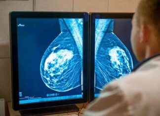 Genetik Keşifler Siyah Kadınların Yüksek Meme Kanseri Ölüm Riskini Azaltabilir genetik-keifler-siyah-kadnlarn-yksek-meme-kanseri-lm-riskini-azaltabilir