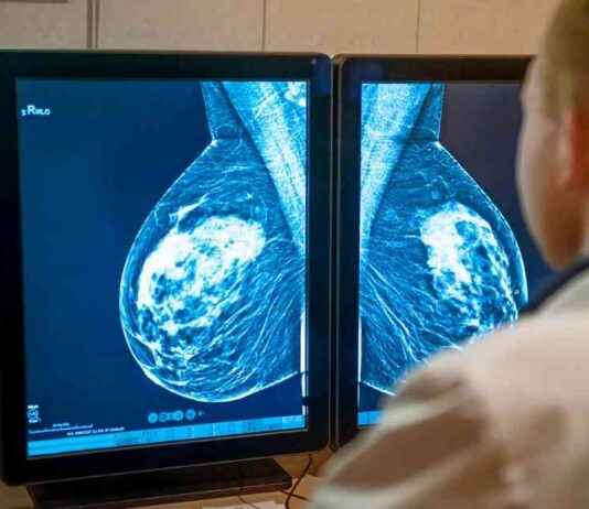 Genetik Keşifler Siyah Kadınların Yüksek Meme Kanseri Ölüm Riskini Azaltabilir genetik-keifler-siyah-kadnlarn-yksek-meme-kanseri-lm-riskini-azaltabilir